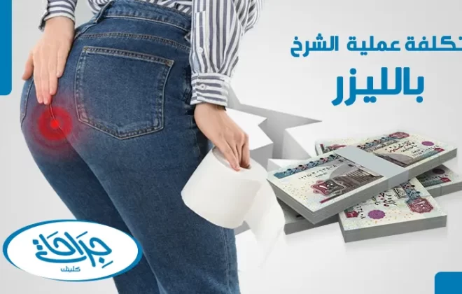 تكلفة عملية الشرخ بالليزر