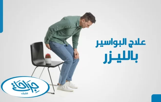 عملية البواسير بالليزر