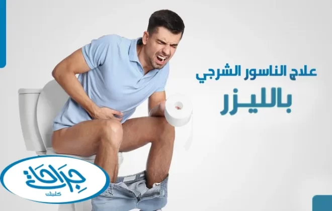 علاج الناسور الشرجي بالليزر