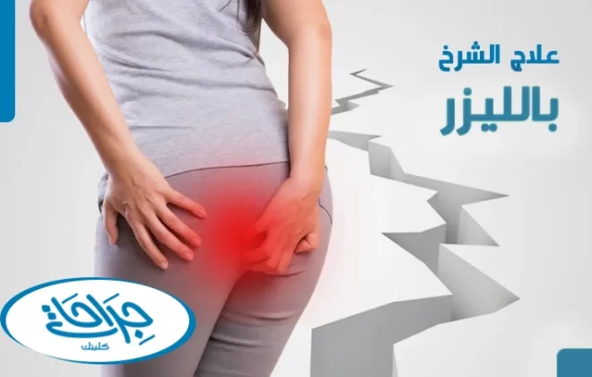 علاج الشرخ بالليزر