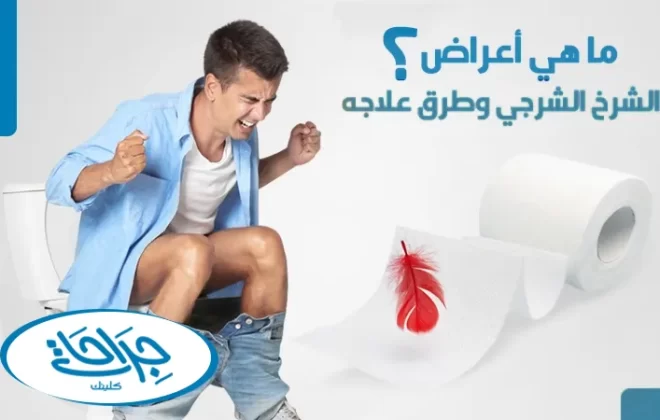 أعراض الشرخ الشرجي