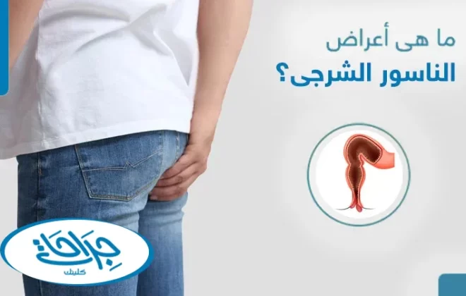 ما هي اعراض الناسور الشرجي
