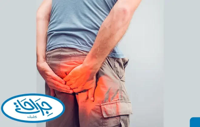 علاج البواسير للرجال