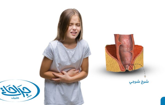 شكل الشرخ بالصور عند الاطفال