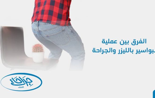 الفرق بين عملية البواسير بالليزر والجراحة