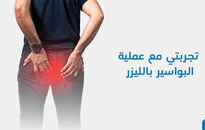تجربتي مع عملية البواسير بالليزر