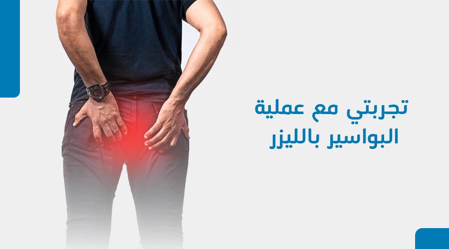 تجربتي مع عملية البواسير بالليزر