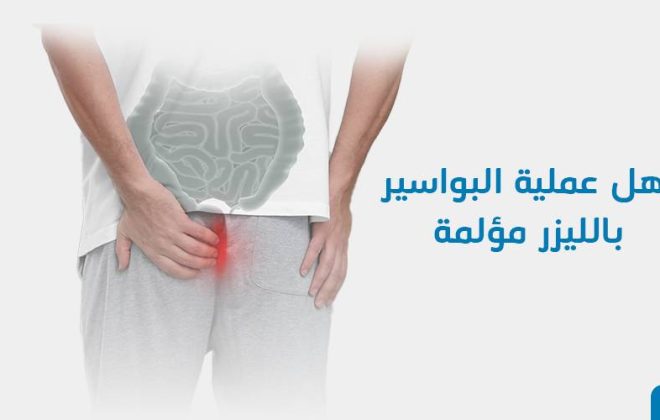 هل عملية البواسير بالليزر مؤلمة