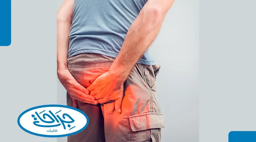 علاج يقضي على البواسير نهائيا مع دكتور أحمد إبراهيم