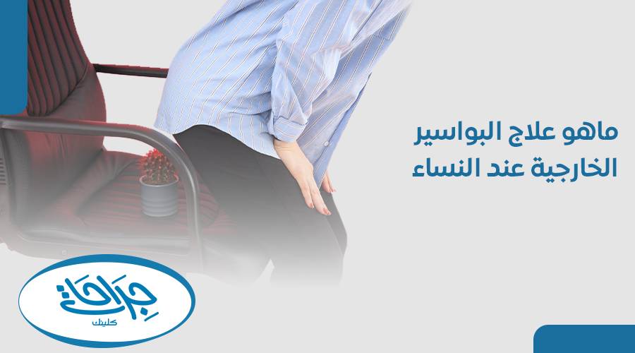 ماهو علاج البواسير الخارجية عند النساء