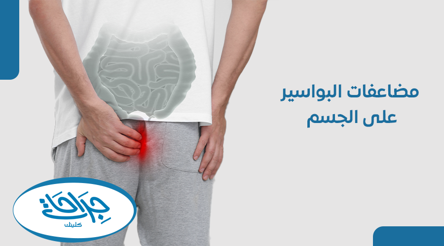 مضاعفات البواسير على الجسم