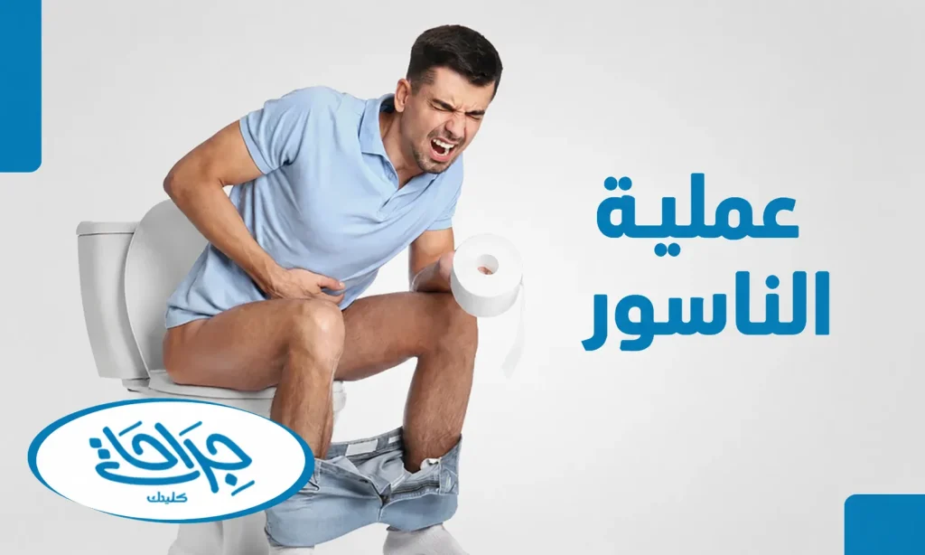 عملية الناسور