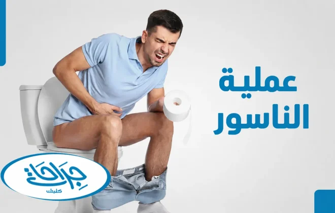 عملية الناسور