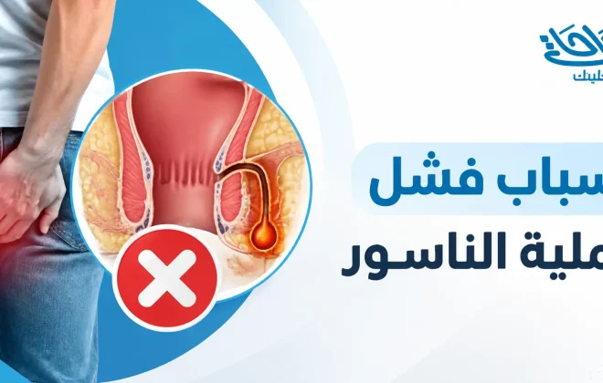 أسباب فشل عملية الناسور
