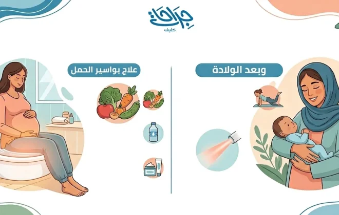 علاج بواسير الحمل وبعد الولادة