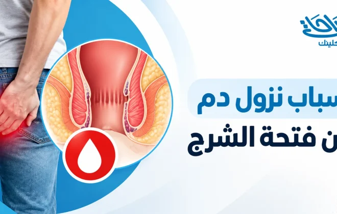اسباب نزول دم من فتحة الشرج